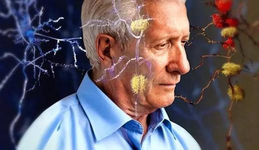 全球五千万人的患老年痴呆怎么延缓?(图1) 全球五千万人的患老年痴呆怎么延缓?(图1)