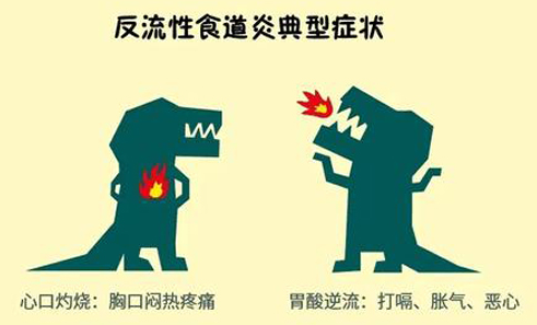 反流性食管炎总是反复发作？怎么办？