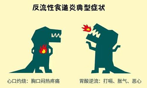 反流性食管炎总是反复发作?怎么办?(图2) 反流性食管炎总是反复发作?怎么办?(图2)